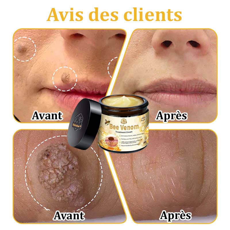 Raindew™ Bijengif Huidherstellende Crème (door dermatologen aanbevolen)👩⚕️