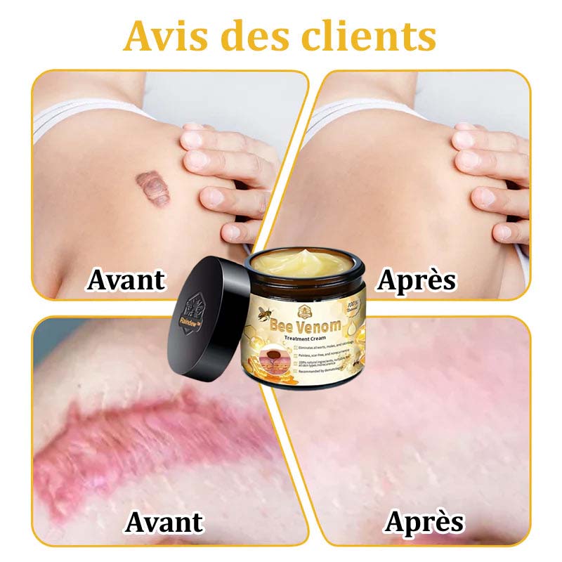 Raindew™ Bijengif Huidherstellende Crème (door dermatologen aanbevolen)👩⚕️