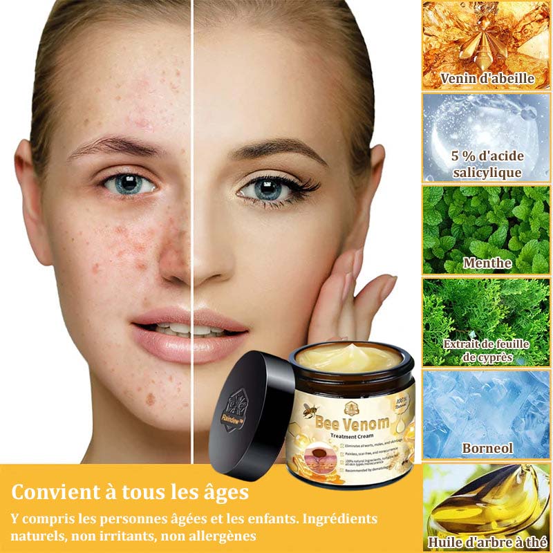 Raindew™ Bijengif Huidherstellende Crème (door dermatologen aanbevolen)👩⚕️