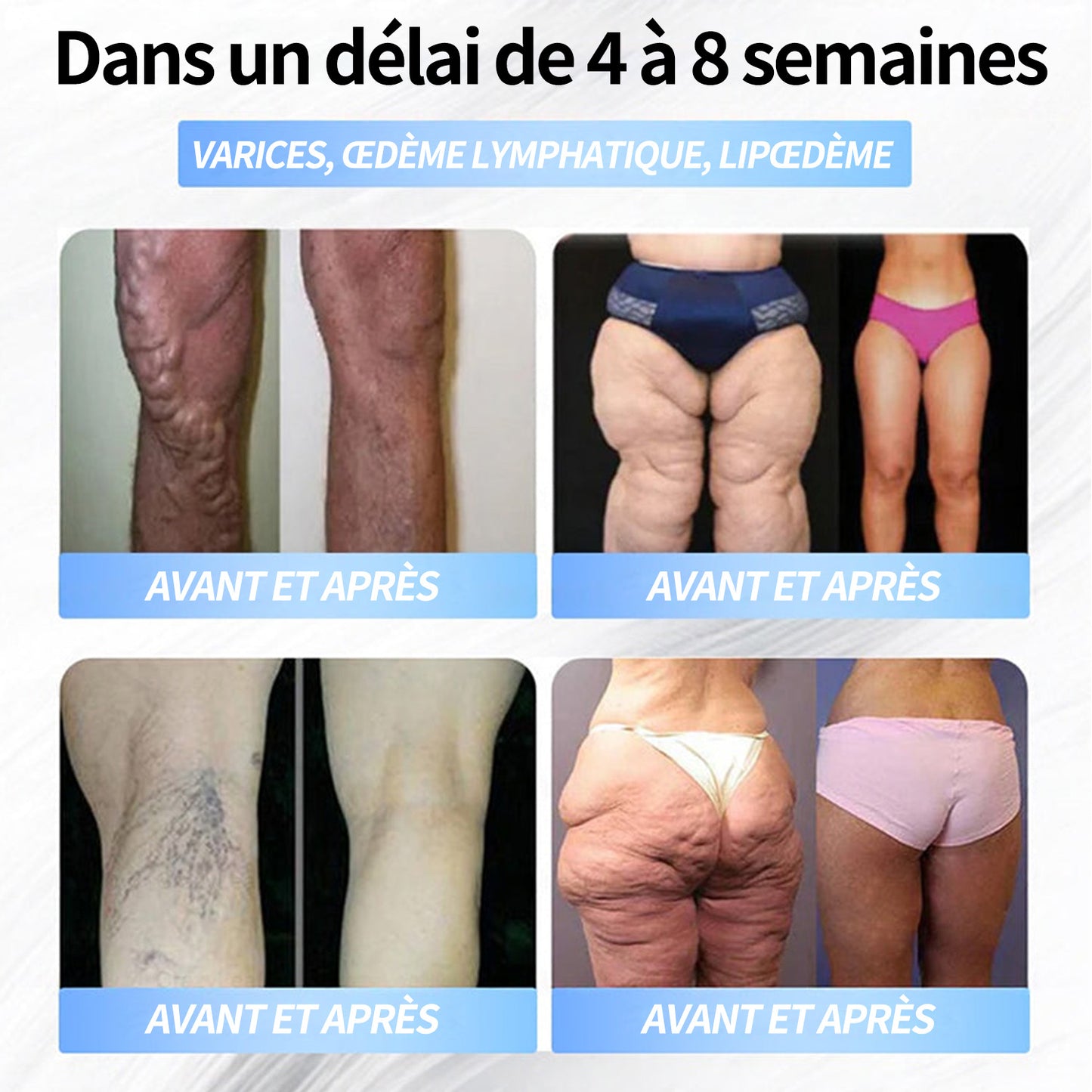 Boutique officielle | Patch nano-micro-aiguilles Pité-Salpétrière GLP-1 Slim & Firm au collagène, curcuma et Matrixyl 3000 pour l'obésité, les maladies cardiovasculaires, le diabète, l'apnée du sommeil, les problèmes articulaires et plus encore.