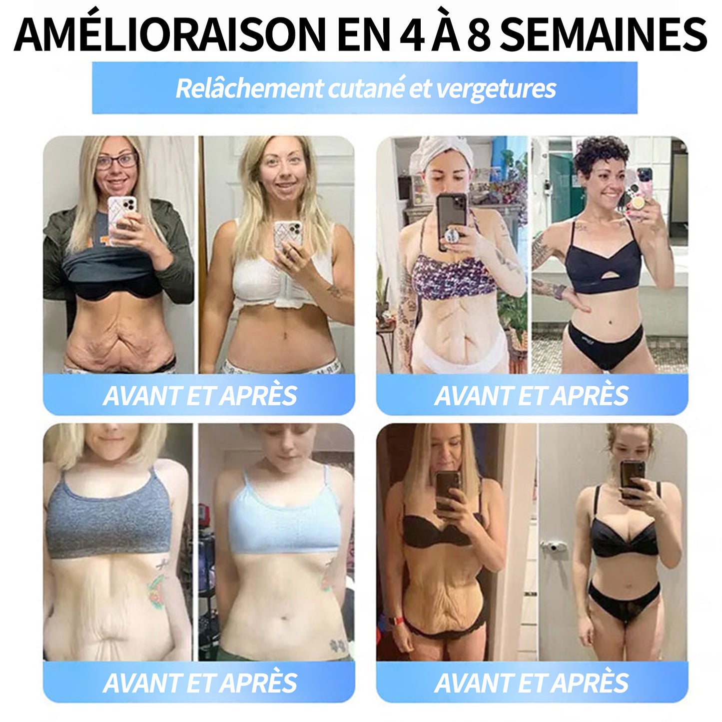 Boutique officielle | Patch nano-micro-aiguilles Pité-Salpétrière GLP-1 Slim & Firm au collagène, curcuma et Matrixyl 3000 pour l'obésité, les maladies cardiovasculaires, le diabète, l'apnée du sommeil, les problèmes articulaires et plus encore.