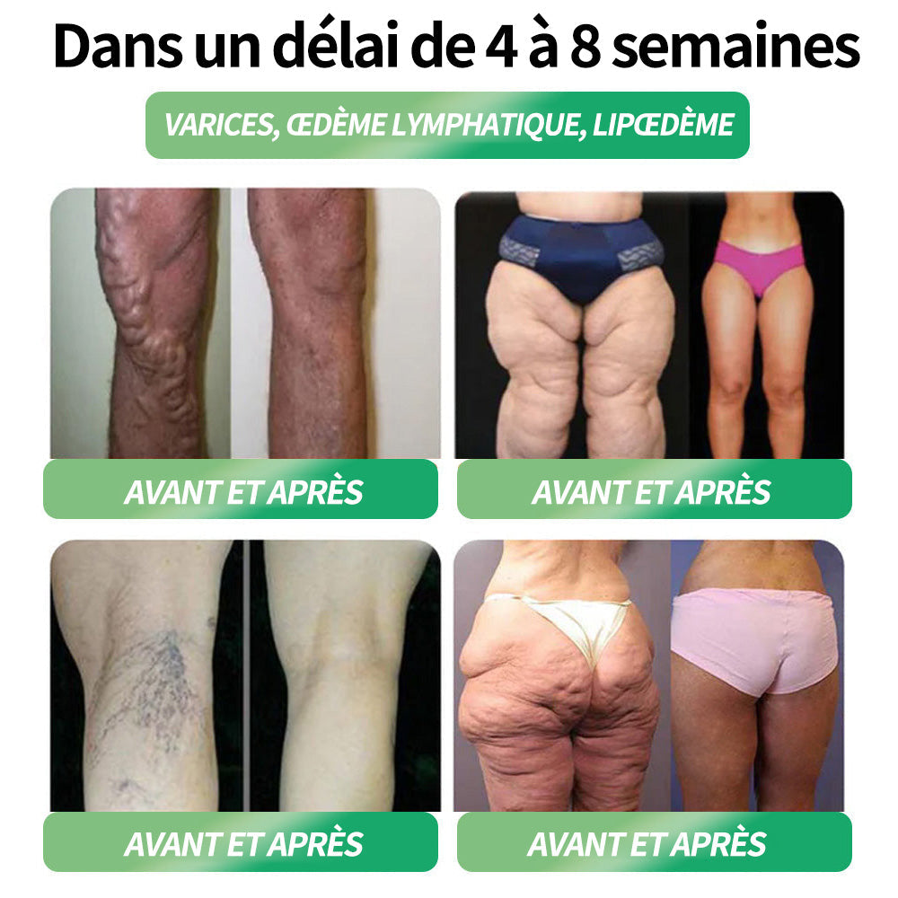 🇫🇷Honxi®NAD+ GLP-1 Liquide oral pour la perte de poids et la santé métabolique✅ Pour l'obésité, la santé cardiovasculaire, le diabète, l'apnée du sommeil, les problèmes articulaires et plus encore.