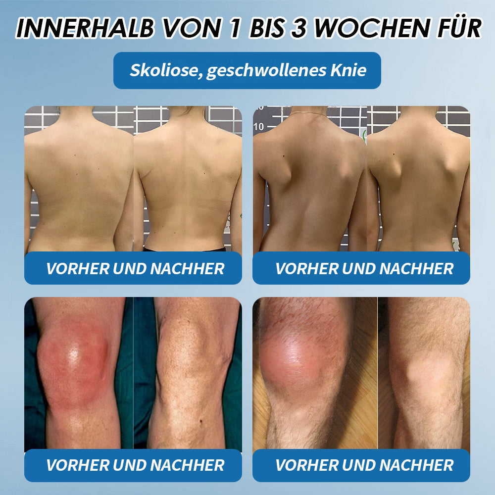 LOTMAY® BPC-157 Gelenk- & Muskelbehandlung Creme 🦴 Behandelt Arthritis, Neuropathie, Rheuma, Sportverletzungen & mehr 🌹