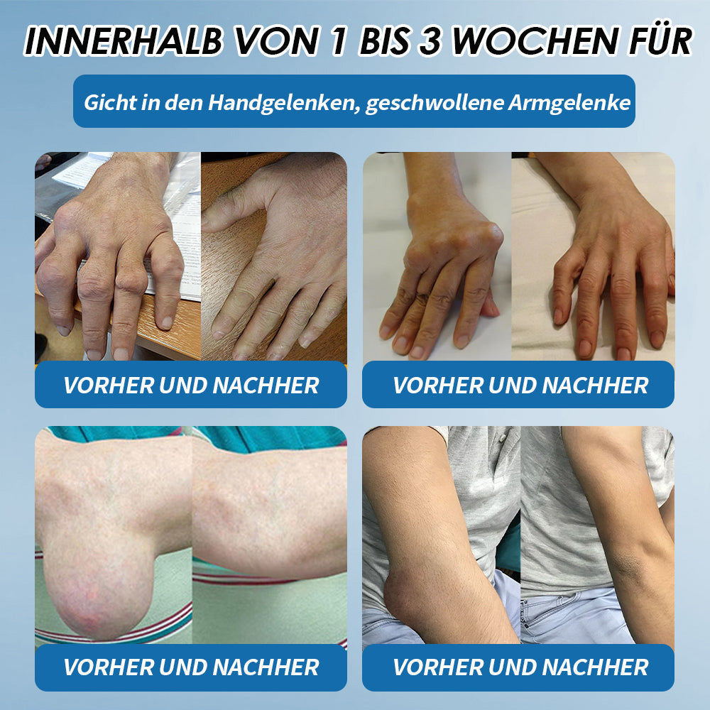 LOTMAY® BPC-157 Gelenk- & Muskelbehandlung Creme 🦴 Behandelt Arthritis, Neuropathie, Rheuma, Sportverletzungen & mehr 🌹
