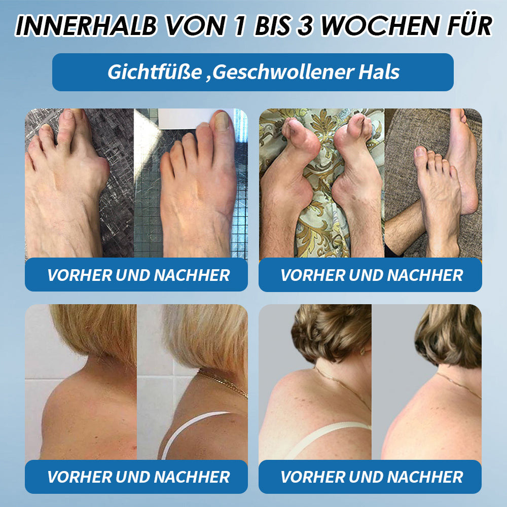 LOTMAY® BPC-157 Gelenk- & Muskelbehandlung Creme 🦴 Behandelt Arthritis, Neuropathie, Rheuma, Sportverletzungen & mehr 🌹