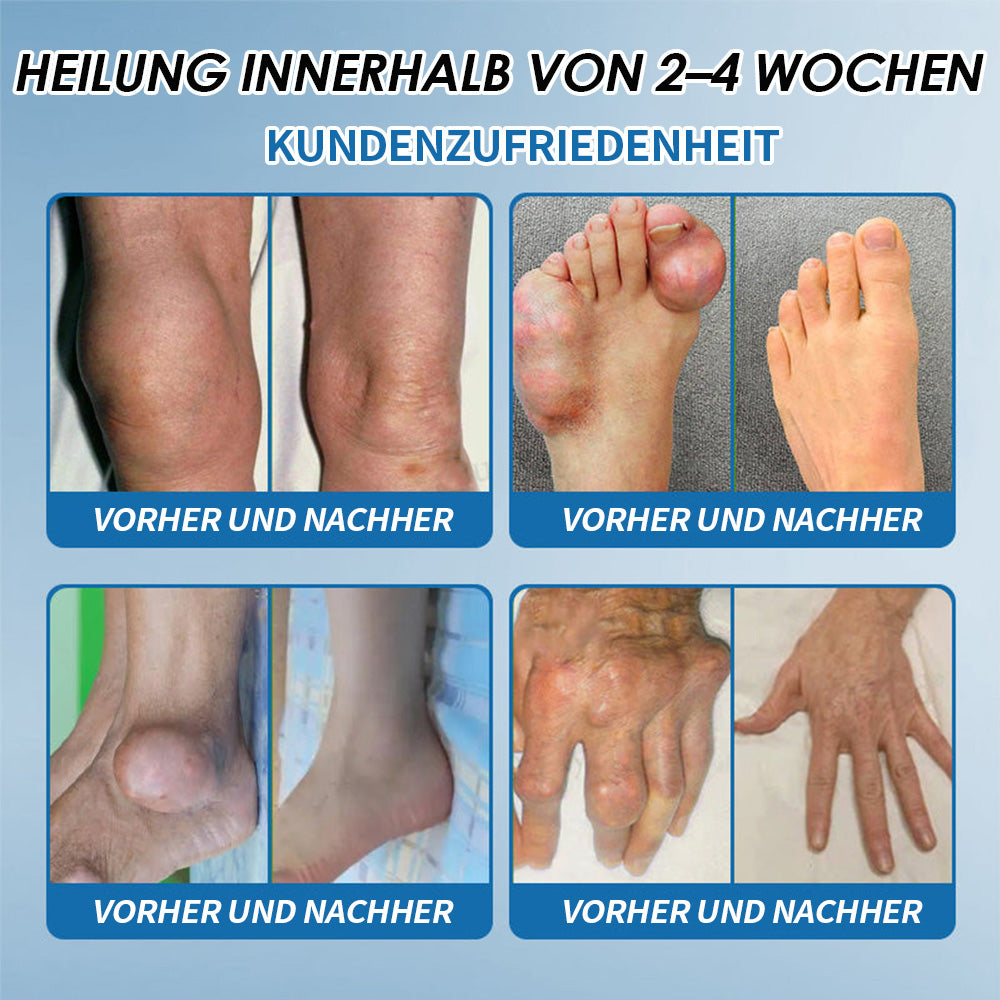 LOTMAY® BPC-157 Gelenk- & Muskelbehandlung Creme 🦴 Behandelt Arthritis, Neuropathie, Rheuma, Sportverletzungen & mehr 🌹