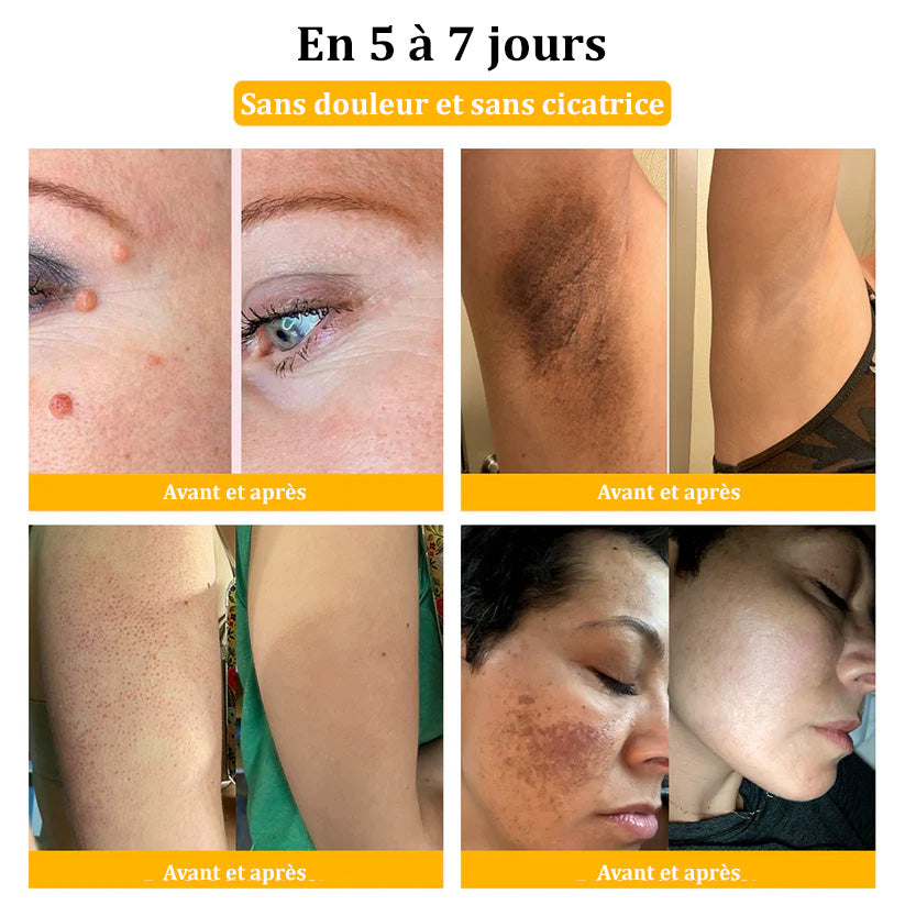 Raindew™ Bijengif Huidherstellende Crème (door dermatologen aanbevolen)👩⚕️