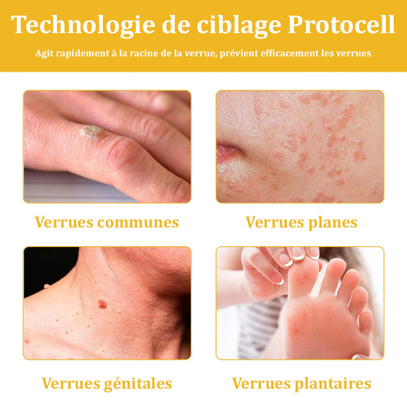 Raindew™ Bijengif Huidherstellende Crème (door dermatologen aanbevolen)👩⚕️