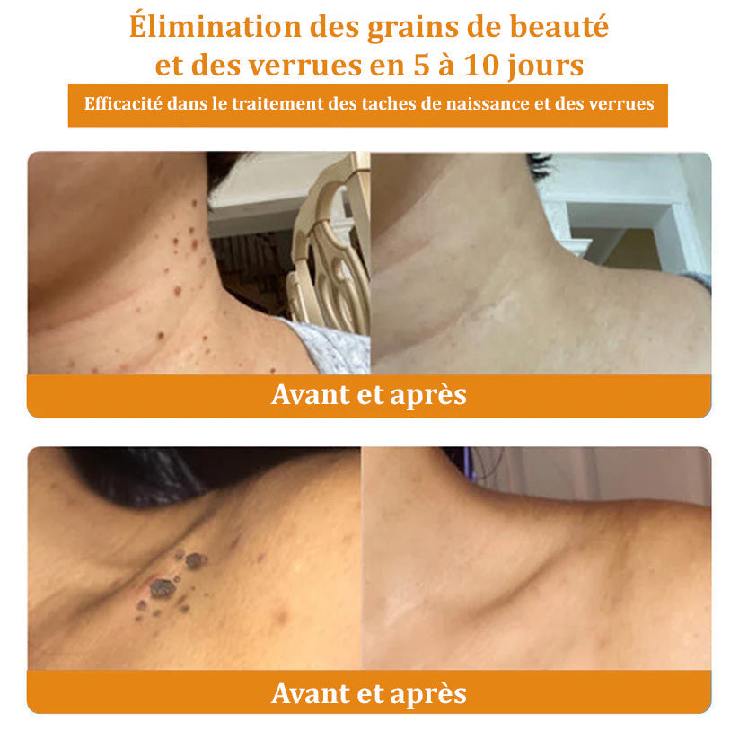 Raindew™ Bijengif Huidherstellende Crème (door dermatologen aanbevolen)👩⚕️