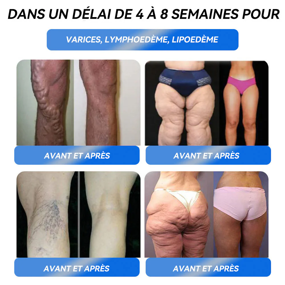 Honxi® 👨⚕️𝐆𝐋𝐏-𝟏 𝐌𝐚𝐱 𝐒𝐨𝐥𝐮𝐭𝐢𝐨𝐧 𝐨𝐫𝐚𝐥𝐞 𝐩𝐨𝐮𝐫 𝐥𝐚 𝐩𝐞𝐫𝐭𝐞 𝐝𝐞 𝐩𝐨𝐢𝐝𝐬 🔥Une dose par jour — voyez les résultats en 7 jours⏱️