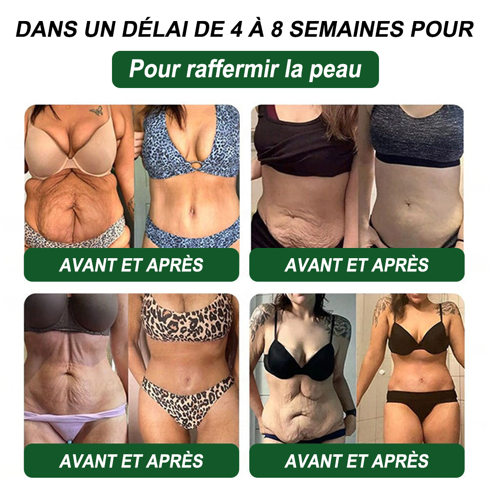 Croaie® NAD+𝐆𝐋𝐏-𝟏 𝐅𝐢𝐭 & 𝐕𝐢𝐭𝐚𝐥 𝐒𝐨𝐥𝐮𝐭𝐢𝐨𝐧 𝐎𝐫𝐚𝐥𝐞 𝟏 𝐟𝐨𝐢𝐬 𝐩𝐚𝐫 𝐣𝐨𝐮𝐫 ✅𝐂𝐨𝐧𝐭𝐫𝐢𝐛𝐮𝐞 à 𝐥𝐚 𝐠𝐞𝐬𝐭𝐢𝐨𝐧 𝐝𝐮 𝐩𝐨𝐢𝐝𝐬, à 𝐥𝐚 𝐬𝐚𝐧𝐭é 𝐜𝐚𝐫𝐝𝐢𝐚𝐪𝐮𝐞, 𝐚𝐮 𝐛𝐢𝐞𝐧-ê𝐭𝐫𝐞 𝐦é𝐭𝐚𝐛𝐨𝐥𝐢𝐪𝐮𝐞 𝐞𝐭 𝐝𝐢𝐠𝐞𝐬𝐭𝐢𝐟, 𝐚𝐢𝐧𝐬𝐢 𝐪𝐮’à 𝐥’é𝐪𝐮𝐢𝐥𝐢𝐛𝐫𝐞 𝐟é𝐦𝐢𝐧𝐢𝐧, 𝐭𝐨𝐮𝐭 𝐞𝐧 𝐫𝐚𝐟𝐟𝐞𝐫𝐦𝐢𝐬𝐬𝐚𝐧𝐭 𝐥𝐚 𝐩𝐞𝐚𝐮 𝐞𝐭 𝐞𝐧 𝐚𝐩𝐩𝐨𝐫𝐭𝐚𝐧𝐭 𝐮𝐧 𝐫𝐞𝐠𝐚𝐢𝐧 𝐝’é𝐧𝐞𝐫𝐠𝐢𝐞