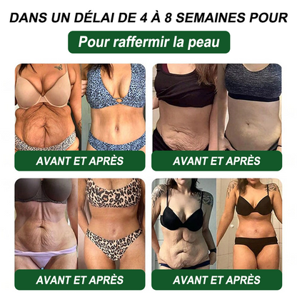 Croaie® NAD+𝐆𝐋𝐏-𝟏 𝐅𝐢𝐭 & 𝐕𝐢𝐭𝐚𝐥 𝐒𝐨𝐥𝐮𝐭𝐢𝐨𝐧 𝐎𝐫𝐚𝐥𝐞 𝟏 𝐟𝐨𝐢𝐬 𝐩𝐚𝐫 𝐣𝐨𝐮𝐫 ✅𝐂𝐨𝐧𝐭𝐫𝐢𝐛𝐮𝐞 à 𝐥𝐚 𝐠𝐞𝐬𝐭𝐢𝐨𝐧 𝐝𝐮 𝐩𝐨𝐢𝐝𝐬, à 𝐥𝐚 𝐬𝐚𝐧𝐭é 𝐜𝐚𝐫𝐝𝐢𝐚𝐪𝐮𝐞, 𝐚𝐮 𝐛𝐢𝐞𝐧-ê𝐭𝐫𝐞 𝐦é𝐭𝐚𝐛𝐨𝐥𝐢𝐪𝐮𝐞 𝐞𝐭 𝐝𝐢𝐠𝐞𝐬𝐭𝐢𝐟, 𝐚𝐢𝐧𝐬𝐢 𝐪𝐮’à 𝐥’é𝐪𝐮𝐢𝐥𝐢𝐛𝐫𝐞 𝐟é𝐦𝐢𝐧𝐢𝐧, 𝐭𝐨𝐮𝐭 𝐞𝐧 𝐫𝐚𝐟𝐟𝐞𝐫𝐦𝐢𝐬𝐬𝐚𝐧𝐭 𝐥𝐚 𝐩𝐞𝐚𝐮 𝐞𝐭 𝐞𝐧 𝐚𝐩𝐩𝐨𝐫𝐭𝐚𝐧𝐭 𝐮𝐧 𝐫𝐞𝐠𝐚𝐢𝐧 𝐝’é𝐧𝐞𝐫𝐠𝐢𝐞