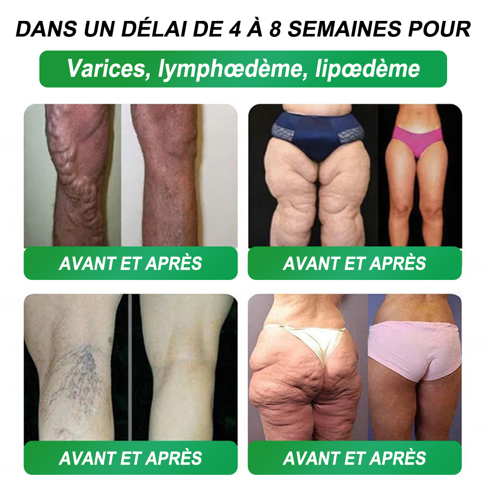 Croaie® NAD+𝐆𝐋𝐏-𝟏 𝐅𝐢𝐭 & 𝐕𝐢𝐭𝐚𝐥 𝐒𝐨𝐥𝐮𝐭𝐢𝐨𝐧 𝐎𝐫𝐚𝐥𝐞 𝟏 𝐟𝐨𝐢𝐬 𝐩𝐚𝐫 𝐣𝐨𝐮𝐫 ✅𝐂𝐨𝐧𝐭𝐫𝐢𝐛𝐮𝐞 à 𝐥𝐚 𝐠𝐞𝐬𝐭𝐢𝐨𝐧 𝐝𝐮 𝐩𝐨𝐢𝐝𝐬, à 𝐥𝐚 𝐬𝐚𝐧𝐭é 𝐜𝐚𝐫𝐝𝐢𝐚𝐪𝐮𝐞, 𝐚𝐮 𝐛𝐢𝐞𝐧-ê𝐭𝐫𝐞 𝐦é𝐭𝐚𝐛𝐨𝐥𝐢𝐪𝐮𝐞 𝐞𝐭 𝐝𝐢𝐠𝐞𝐬𝐭𝐢𝐟, 𝐚𝐢𝐧𝐬𝐢 𝐪𝐮’à 𝐥’é𝐪𝐮𝐢𝐥𝐢𝐛𝐫𝐞 𝐟é𝐦𝐢𝐧𝐢𝐧, 𝐭𝐨𝐮𝐭 𝐞𝐧 𝐫𝐚𝐟𝐟𝐞𝐫𝐦𝐢𝐬𝐬𝐚𝐧𝐭 𝐥𝐚 𝐩𝐞𝐚𝐮 𝐞𝐭 𝐞𝐧 𝐚𝐩𝐩𝐨𝐫𝐭𝐚𝐧𝐭 𝐮𝐧 𝐫𝐞𝐠𝐚𝐢𝐧 𝐝’é𝐧𝐞𝐫𝐠𝐢𝐞