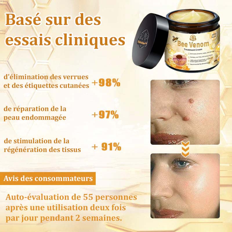 Raindew™ Bijengif Huidherstellende Crème (door dermatologen aanbevolen)👩‍⚕️