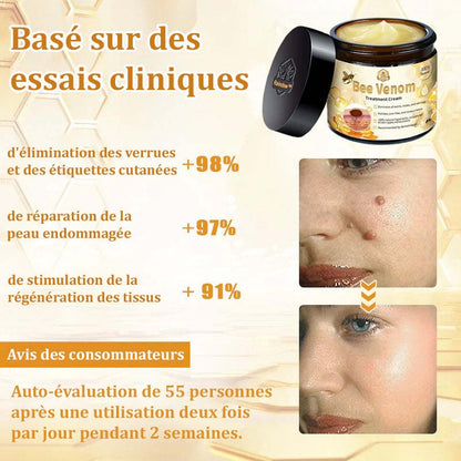 Raindew™ Bijengif Huidherstellende Crème (door dermatologen aanbevolen)👩‍⚕️