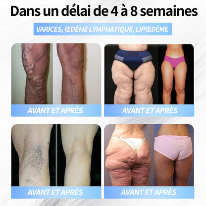 Boutique officielle | Patch nano-micro-aiguilles Pité-Salpétrière GLP-1 Slim & Firm au collagène, curcuma et Matrixyl 3000 pour l'obésité, les maladies cardiovasculaires, le diabète, l'apnée du sommeil, les problèmes articulaires et plus encore.