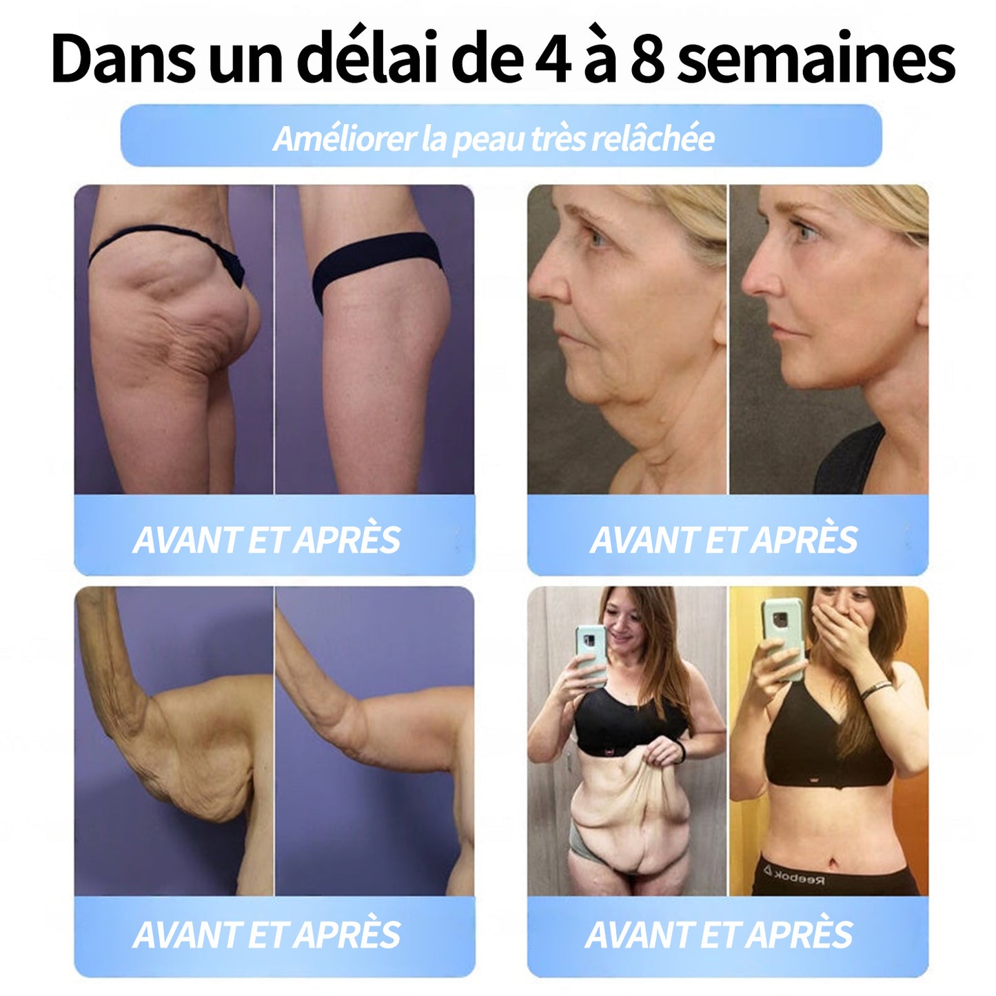 Boutique officielle | Patch nano-micro-aiguilles Pité-Salpétrière GLP-1 Slim & Firm au collagène, curcuma et Matrixyl 3000 pour l'obésité, les maladies cardiovasculaires, le diabète, l'apnée du sommeil, les problèmes articulaires et plus encore.
