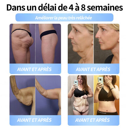 Boutique officielle | Patch nano-micro-aiguilles Pité-Salpétrière GLP-1 Slim & Firm au collagène, curcuma et Matrixyl 3000 pour l'obésité, les maladies cardiovasculaires, le diabète, l'apnée du sommeil, les problèmes articulaires et plus encore.