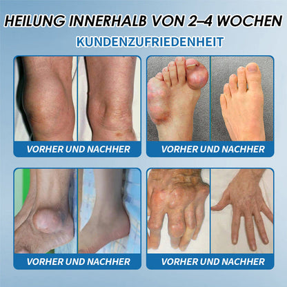 LOTMAY® BPC-157 Gelenk- & Muskelbehandlung Creme 🦴 Behandelt Arthritis, Neuropathie, Rheuma, Sportverletzungen & mehr 🌹